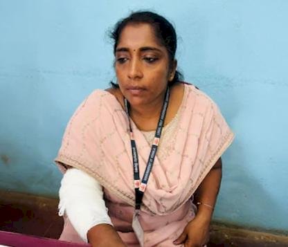​പെൻഷൻ രേഖ ചോദിച്ചു മുക്കം നഗരസഭയിൽ ഉദ്യോഗസ്ഥയ്ക്ക് വീട്ടമ്മയുടെ കടിയേറ്റു